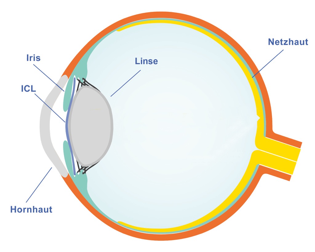 Auge Illustration mit ICL